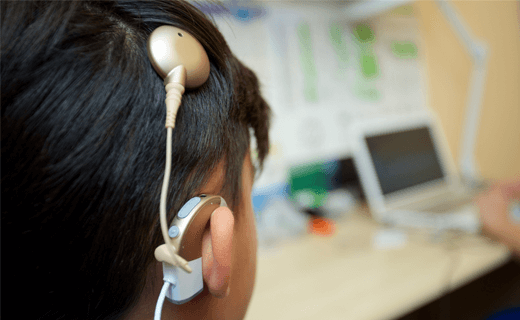 Materials for cochlear implants