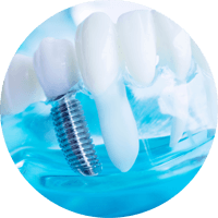 MACOR® pour applications médicales | Goodfellow